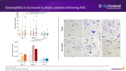 Clinical consequences of immune cell dysfunction in upper and lower airway disease