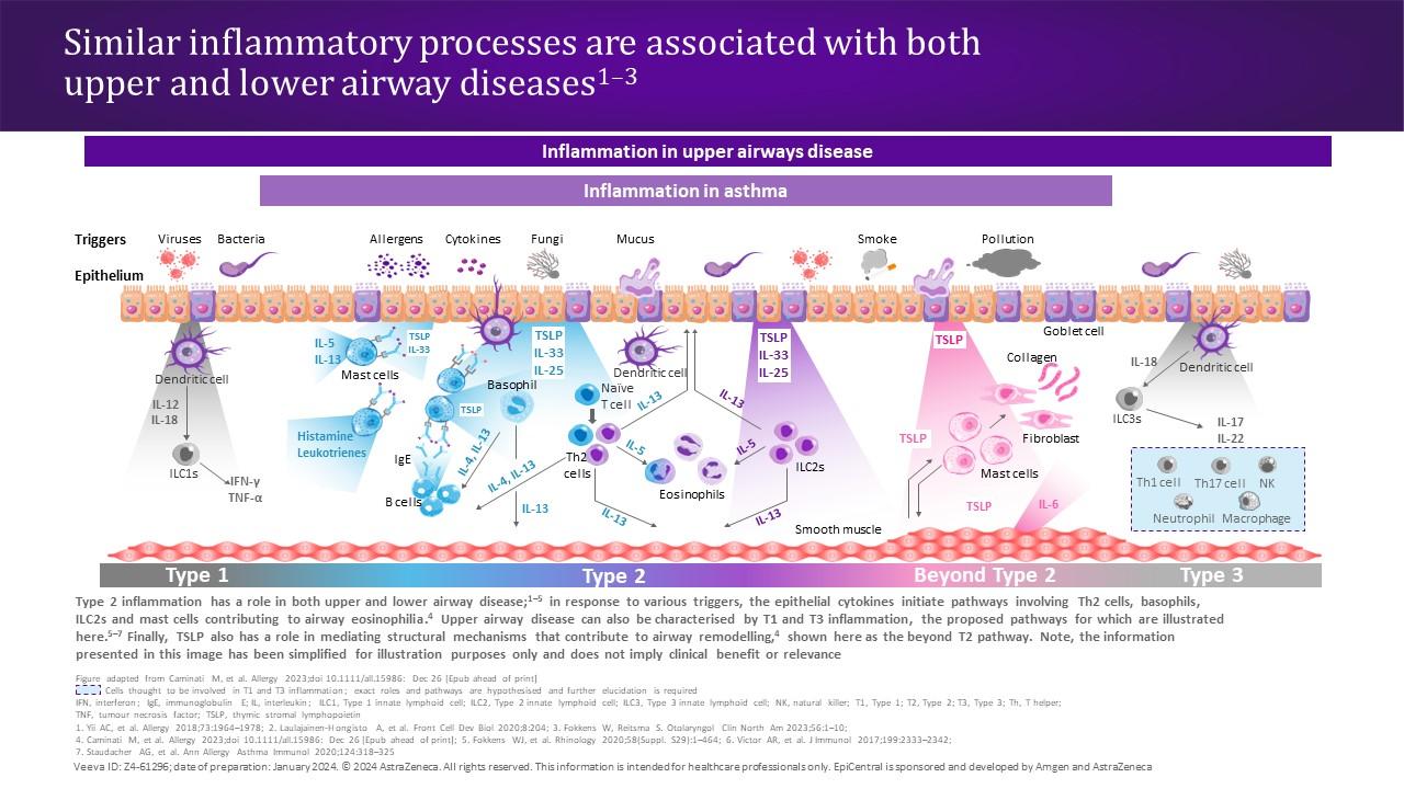 Similar inflammatory processes are associated with both upper and lower airway diseases